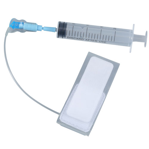 Radial artery tourniquet